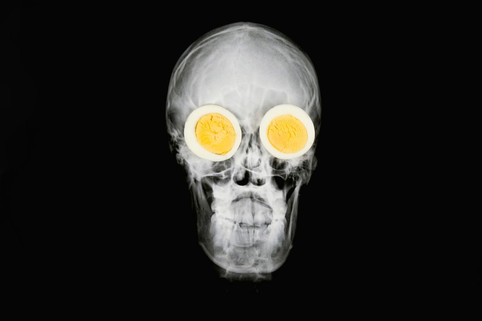Un craneo visto por rayos X con huevos cocidos en sus ojos.