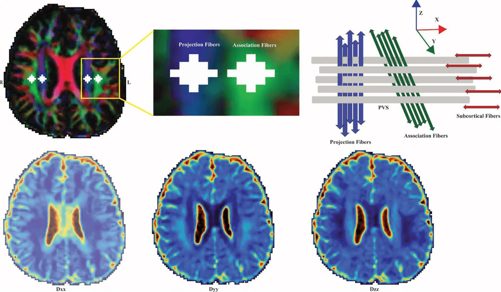 fatiga crónica limpieza cerebral